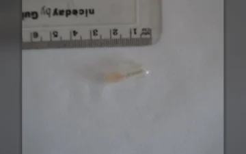 Tabletki Galenika Rivotril (Clonazepam)