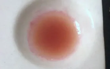 Mephedrone